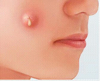 2a1cfe2927254483d06fa52e52dbd99f