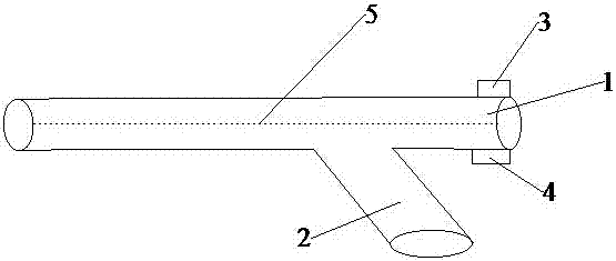 内窥镜电极怎么回事2023年1-4月内镜及配套耗材分类界定结果汇总来袭！_https://www.jmylbn.com_新闻资讯_第5张