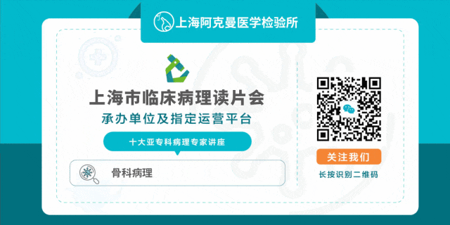 fh染色是什么意思病例分享 ｜ 延胡索酸水合酶（FH）缺陷型子宫平滑肌瘤_https://www.jmylbn.com_新闻资讯_第13张