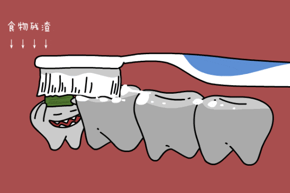 牙科骨凿怎么用嘴里那颗“智齿”到底要不要拔？纠结100次不如听牙科医生说一回_https://www.jmylbn.com_新闻资讯_第11张