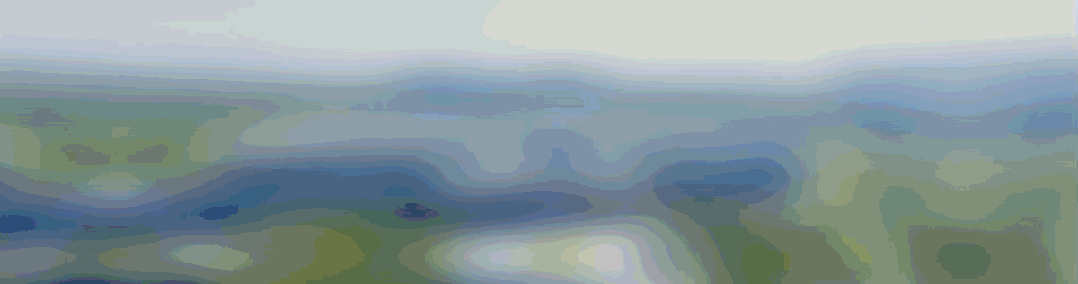 麻醉泵是什么【医学科普】麻醉镇痛泵，你了解多少呢？_https://www.jmylbn.com_新闻资讯_第1张