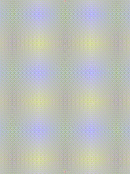 gore医疗怎么样「胸有乾坤」千钧一发 转危为安——Gore TBE治疗急诊破裂TAA一例_https://www.jmylbn.com_新闻资讯_第20张