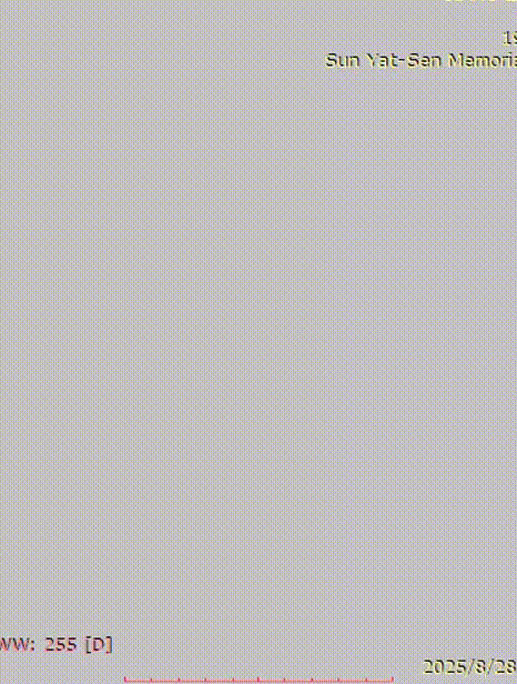 gore医疗怎么样「胸有乾坤」千钧一发 转危为安——Gore TBE治疗急诊破裂TAA一例_https://www.jmylbn.com_新闻资讯_第14张