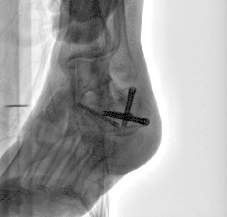 C臂怎么看解密C形臂新晋“单品王”：大视野，三维C；面向未来，一步到位！_https://www.jmylbn.com_新闻资讯_第15张