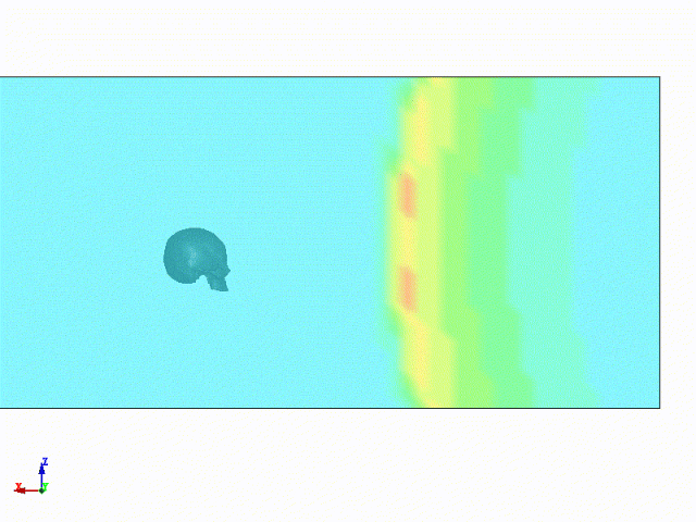 LS-DYNA | 爆炸冲击波对人体头颅作用的图4