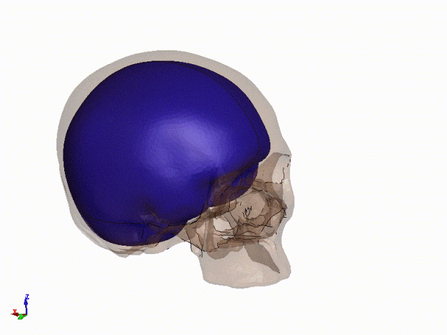 LS-DYNA | 爆炸冲击波对人体头颅作用的图8