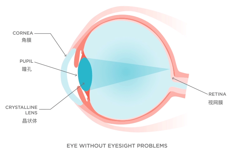 意大利眼科怎么样从意大利飞到杭州，眼睛突然看不见了……_https://www.jmylbn.com_新闻资讯_第8张