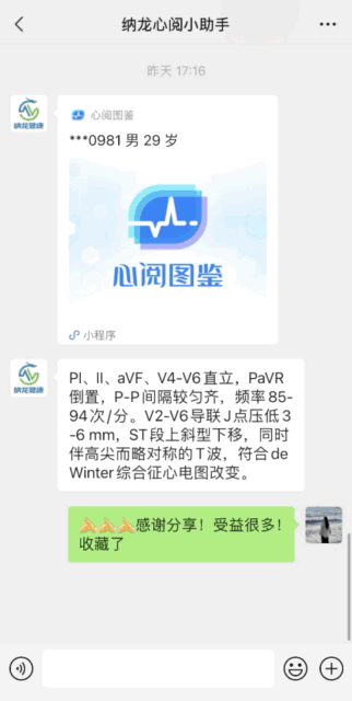 数字心电图怎么使用【心电图收藏家指南】心阅图鉴小程序焕新升级：革新存图方式，打造专属数字化心电图库！_https://www.jmylbn.com_新闻资讯_第10张