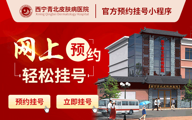 【西宁青北皮肤病医院】导致青少年脱发的原因有哪些