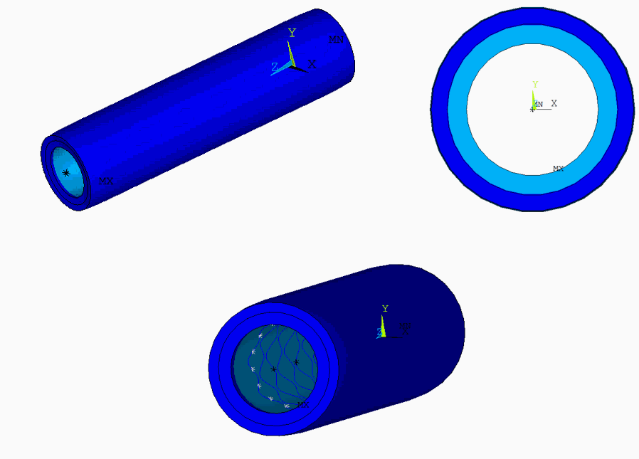 心血管支架移植模拟分析（ANSYS_APDL命令流）的图5