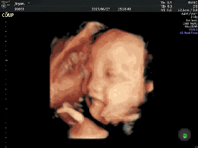 汕头彩超怎么样四维彩超胎儿不配合？孕妇这样做，四维一次过「汕头妇产科医院」_https://www.jmylbn.com_新闻资讯_第6张