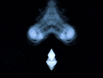 中国哪些医疗设备国产权威发布！2023十大自主创新医疗器械_https://www.jmylbn.com_新闻资讯_第4张