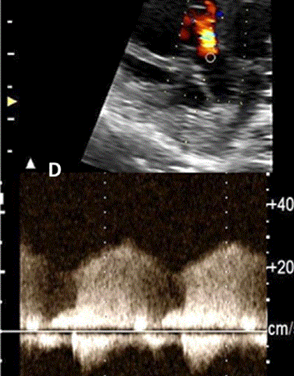 胎儿mt是什么检查什么疼吗ASE胎儿超声心动图检查指南及建议（更新）IV. 针对特定疾病的解剖、生理和功能胎儿超声心动图评估指南-C.结构性心脏病-iv_https://www.jmylbn.com_新闻资讯_第14张