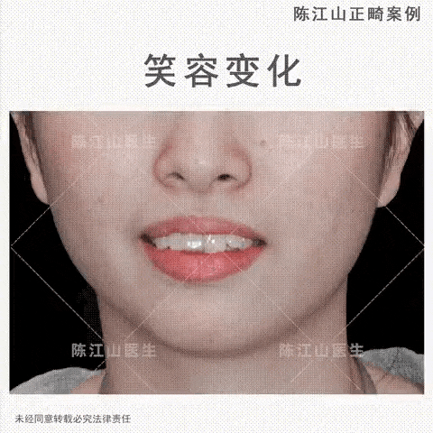 慈恩齿科,正式入驻惠州啦!!! 慈恩齿科,正式入驻惠州啦!!!