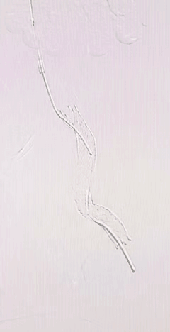 动脉长鞘怎么置入桡胜一筹丨吴巍巍主任、赵俊来教授团队：应用Brite Tip RADIANZ长鞘经桡动脉治疗下肢动脉粥样硬化闭塞症一例_https://www.jmylbn.com_新闻资讯_第21张