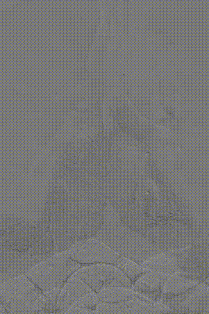 gore医疗怎么样「胸有乾坤」可调可控 遂心应手——GORE® TAG® 可主动调控胸主动脉覆膜支架治疗急性夹层病例报道_https://www.jmylbn.com_新闻资讯_第12张