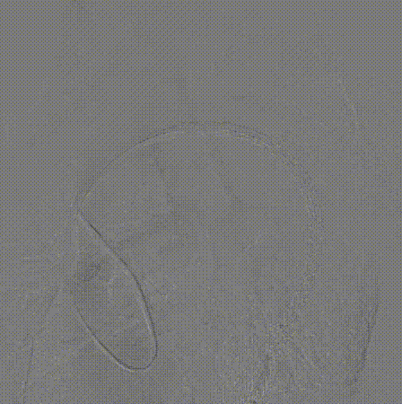 gore医疗怎么样「胸有乾坤」可调可控 遂心应手——GORE® TAG® 可主动调控胸主动脉覆膜支架治疗急性夹层病例报道_https://www.jmylbn.com_新闻资讯_第14张