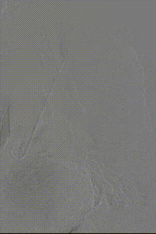 gore医疗怎么样「胸有乾坤」可调可控 遂心应手——GORE® TAG® 可主动调控胸主动脉覆膜支架治疗急性夹层病例报道_https://www.jmylbn.com_新闻资讯_第11张