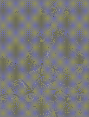 gore医疗怎么样「胸有乾坤」可调可控 遂心应手——GORE® TAG® 可主动调控胸主动脉覆膜支架治疗急性夹层病例报道_https://www.jmylbn.com_新闻资讯_第13张