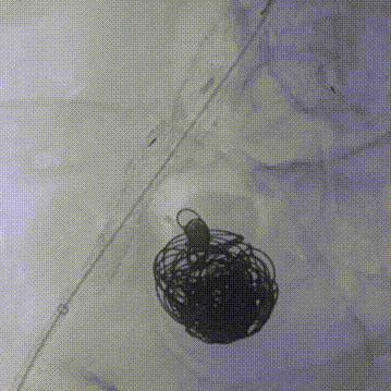 gore医疗怎么样【膜Shu前沿】精准封堵——GORE VBX球囊扩张覆膜支架联合弹簧圈治疗髂内动脉瘤_https://www.jmylbn.com_新闻资讯_第10张