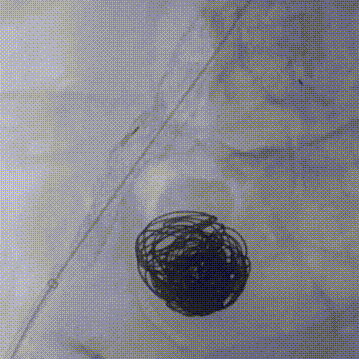 gore医疗怎么样【膜Shu前沿】精准封堵——GORE VBX球囊扩张覆膜支架联合弹簧圈治疗髂内动脉瘤_https://www.jmylbn.com_新闻资讯_第9张