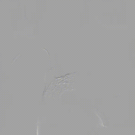 斑马导丝是治疗什么的「胸有乾坤」至简至易 行之有效—— Zone 0 TBE植入治疗弓部动脉瘤病例报道_https://www.jmylbn.com_新闻资讯_第24张