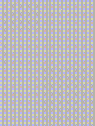 gore医疗怎么样「胸有乾坤」可调可控 从容不迫——GORE® TAG® 可主动调控胸主动脉覆膜支架治疗巨大胸主动脉瘤病例报道_https://www.jmylbn.com_新闻资讯_第30张