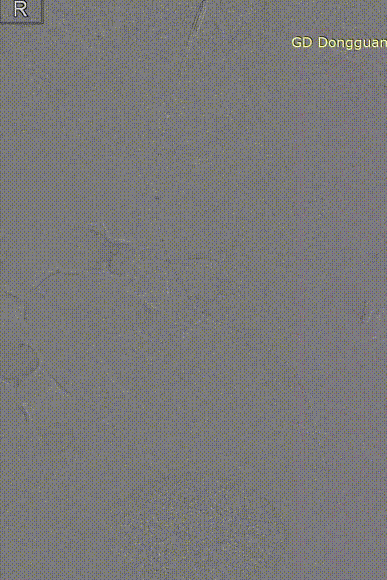 gore医疗怎么样「胸有乾坤」危如累卵 妙手回春——Conformable GORE®TAG®胸主动脉覆膜支架应用于高龄急性主动脉夹层治疗_https://www.jmylbn.com_新闻资讯_第34张