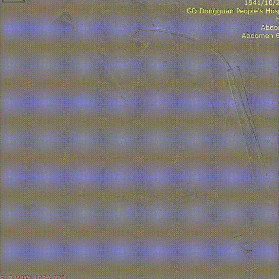 gore医疗怎么样「胸有乾坤」危如累卵 妙手回春——Conformable GORE®TAG®胸主动脉覆膜支架应用于高龄急性主动脉夹层治疗_https://www.jmylbn.com_新闻资讯_第36张