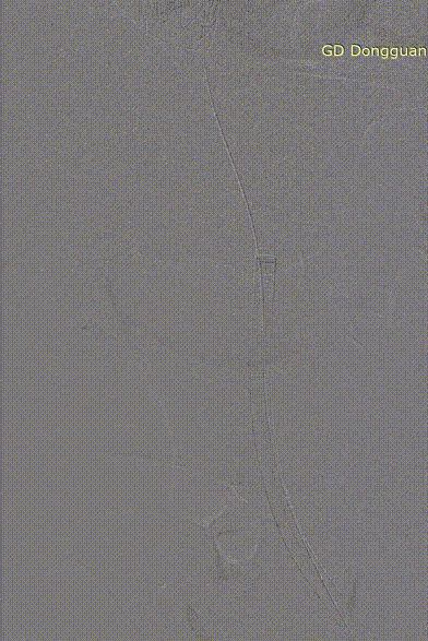 gore医疗怎么样「胸有乾坤」危如累卵 妙手回春——Conformable GORE®TAG®胸主动脉覆膜支架应用于高龄急性主动脉夹层治疗_https://www.jmylbn.com_新闻资讯_第33张