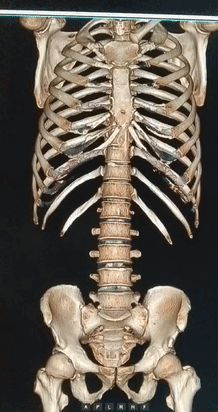 联影有哪些CT我院放射科再添“硬核“利器—联影60排120层螺旋CT机_https://www.jmylbn.com_新闻资讯_第16张