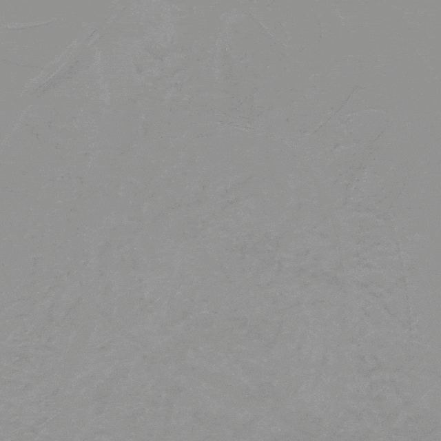 泥鳅导丝怎么用曲乐丰教授团队：0.018＂和0.035＂普通泥鳅导丝行胸主动脉弓上分支原位开窗的病例分享_https://www.jmylbn.com_新闻资讯_第28张