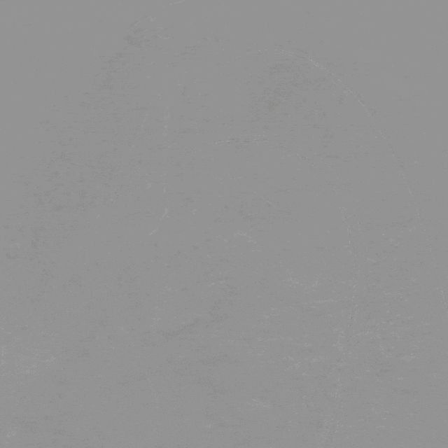 泥鳅导丝怎么用曲乐丰教授团队：0.018＂和0.035＂普通泥鳅导丝行胸主动脉弓上分支原位开窗的病例分享_https://www.jmylbn.com_新闻资讯_第9张