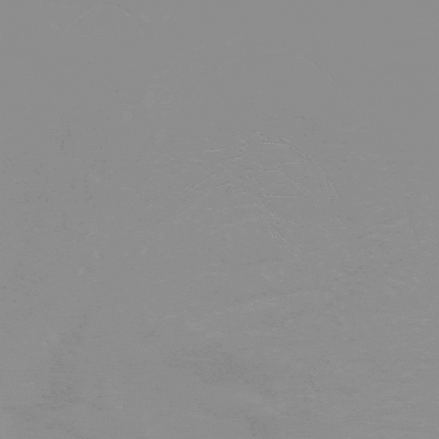 泥鳅导丝怎么用曲乐丰教授团队：0.018＂和0.035＂普通泥鳅导丝行胸主动脉弓上分支原位开窗的病例分享_https://www.jmylbn.com_新闻资讯_第12张