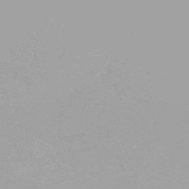 泥鳅导丝怎么用曲乐丰教授团队：0.018＂和0.035＂普通泥鳅导丝行胸主动脉弓上分支原位开窗的病例分享_https://www.jmylbn.com_新闻资讯_第10张