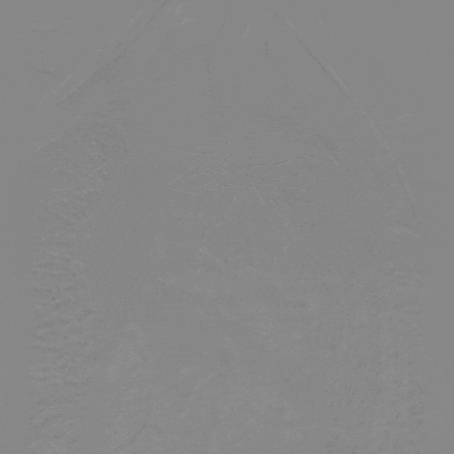 泥鳅导丝怎么用曲乐丰教授团队：0.018＂和0.035＂普通泥鳅导丝行胸主动脉弓上分支原位开窗的病例分享_https://www.jmylbn.com_新闻资讯_第42张