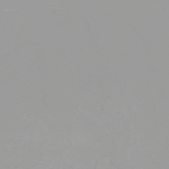 泥鳅导丝怎么用曲乐丰教授团队：0.018＂和0.035＂普通泥鳅导丝行胸主动脉弓上分支原位开窗的病例分享_https://www.jmylbn.com_新闻资讯_第30张