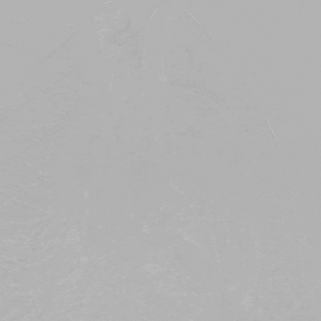 泥鳅导丝怎么用曲乐丰教授团队：0.018＂和0.035＂普通泥鳅导丝行胸主动脉弓上分支原位开窗的病例分享_https://www.jmylbn.com_新闻资讯_第27张