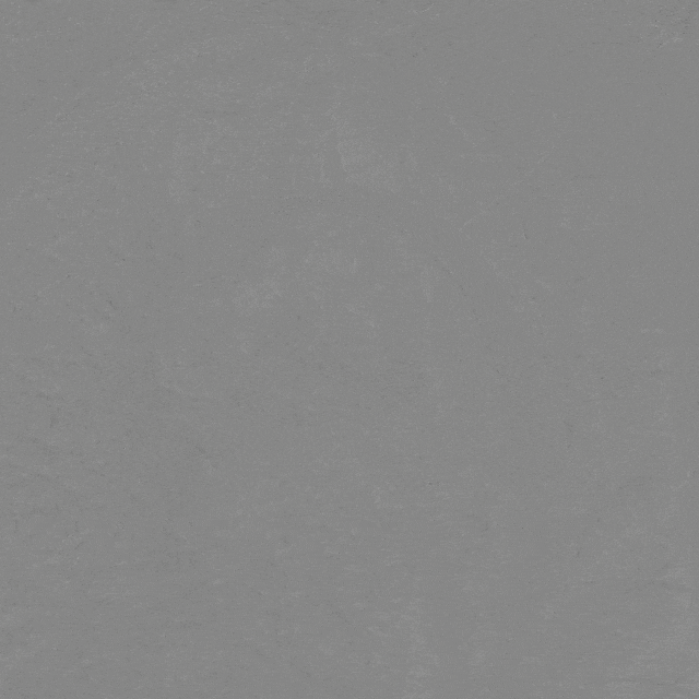 泥鳅导丝怎么用曲乐丰教授团队：0.018＂和0.035＂普通泥鳅导丝行胸主动脉弓上分支原位开窗的病例分享_https://www.jmylbn.com_新闻资讯_第29张