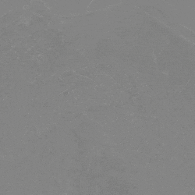 泥鳅导丝怎么用曲乐丰教授团队：0.018＂和0.035＂普通泥鳅导丝行胸主动脉弓上分支原位开窗的病例分享_https://www.jmylbn.com_新闻资讯_第31张