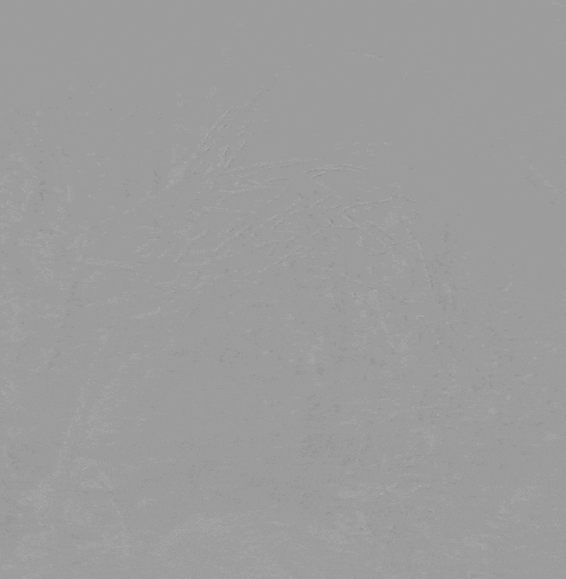 泥鳅导丝怎么用曲乐丰教授团队：0.018＂和0.035＂普通泥鳅导丝行胸主动脉弓上分支原位开窗的病例分享_https://www.jmylbn.com_新闻资讯_第19张