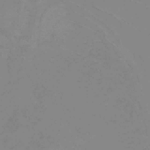 泥鳅导丝怎么用曲乐丰教授团队：0.018＂和0.035＂普通泥鳅导丝行胸主动脉弓上分支原位开窗的病例分享_https://www.jmylbn.com_新闻资讯_第35张