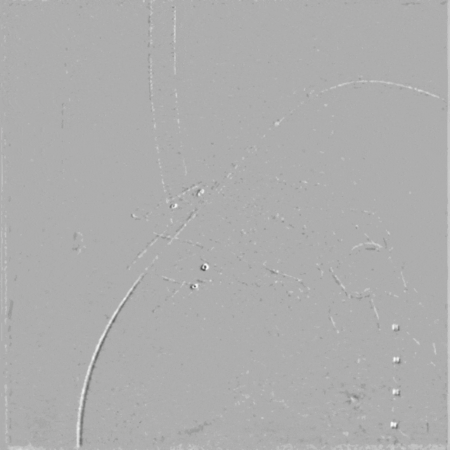 泥鳅导丝怎么用符伟国／王利新教授团队：0.035＂普通泥鳅导丝进行胸主动脉弓上分支原位开窗的病例分享_https://www.jmylbn.com_新闻资讯_第19张