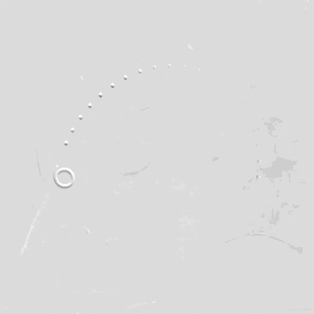 泥鳅导丝怎么用符伟国／王利新教授团队：0.035＂普通泥鳅导丝进行胸主动脉弓上分支原位开窗的病例分享_https://www.jmylbn.com_新闻资讯_第8张
