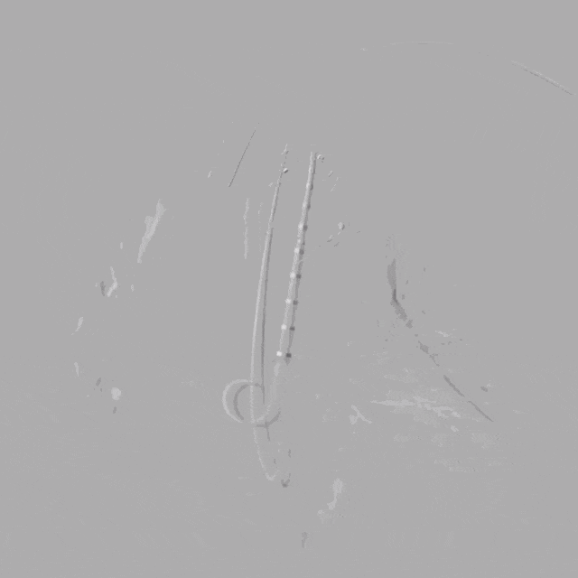 泥鳅导丝怎么用符伟国／王利新教授团队：0.035＂普通泥鳅导丝进行胸主动脉弓上分支原位开窗的病例分享_https://www.jmylbn.com_新闻资讯_第22张