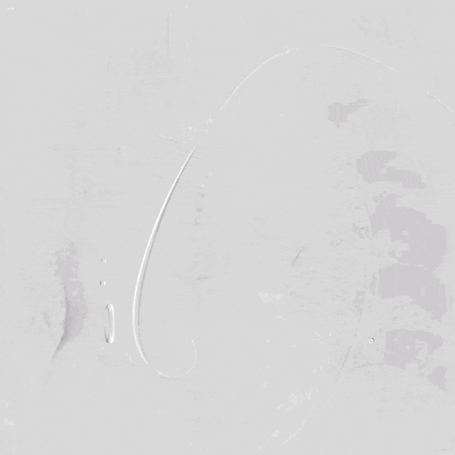 泥鳅导丝怎么用符伟国／王利新教授团队：0.035＂普通泥鳅导丝进行胸主动脉弓上分支原位开窗的病例分享_https://www.jmylbn.com_新闻资讯_第23张