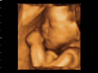 三星彩超怎么样【便民服务】四维彩超界“新王者”——三星HERA女神超声仪，给孕妈妈们一份安心！_https://www.jmylbn.com_新闻资讯_第23张