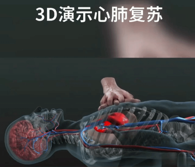 cpr按压板怎么放置【健康之窗】急救科普 ｜ 心肺复苏（CPR）全攻略_https://www.jmylbn.com_新闻资讯_第18张