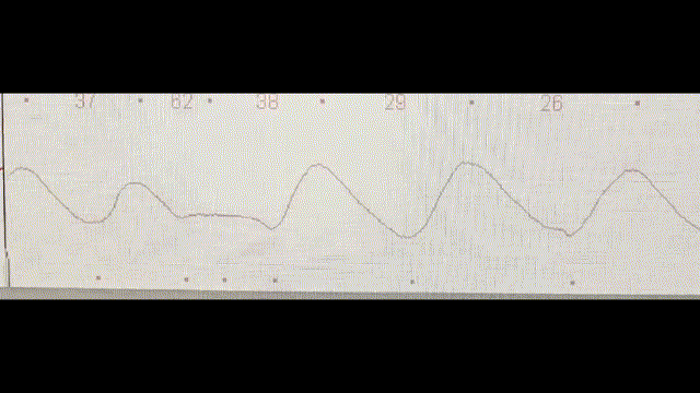 ct机器怎么分辨【科普】四维CT图像：如何助力精准放疗？_https://www.jmylbn.com_新闻资讯_第9张
