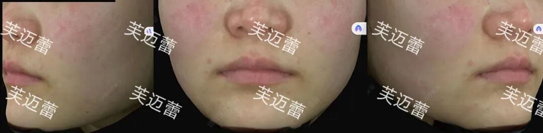 bedf22456f3cee3384543d70f04f12b3.jpg